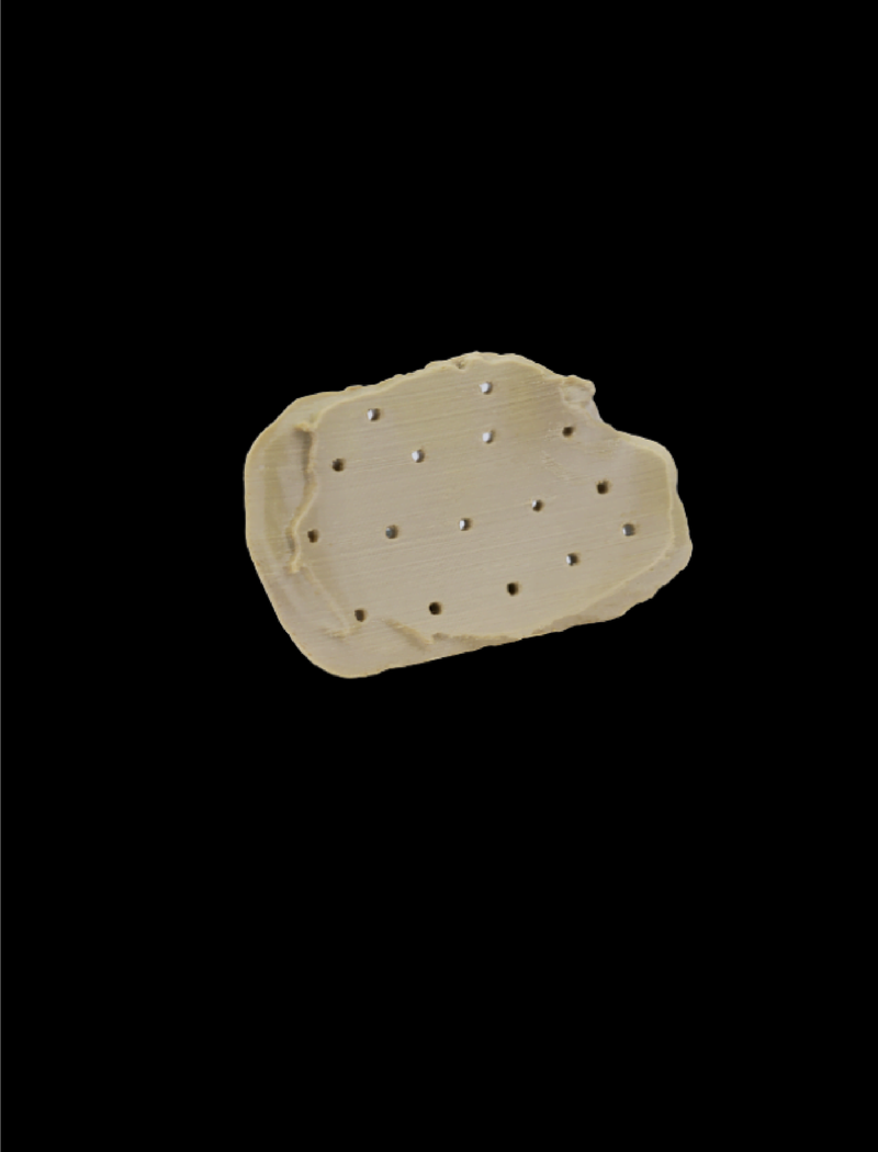 cranial_implant2